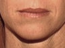 Lips