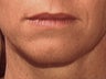 Lips