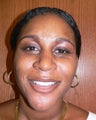 37 year old woman has Rhinoplasty