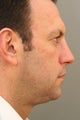 Male Chin Implant