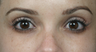 Latisse for Eyelashes
