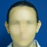 Ear Surgery (Otoplasty)