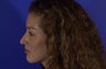 Revision Rhinoplasty
