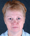 Upper & Lower Blepharoplasty in Combination with a Facelift & Browlift