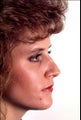 Revision rhinoplasty
