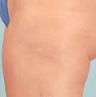 Cellulaze