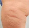 Cellulaze