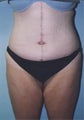 16 year old female patient