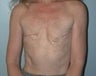 54 year old female patient