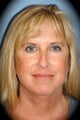 Laser Skin Resurfacing