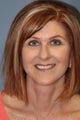 Blue Peel®, LiteLift™, Platysmaplasty on 57-year-old Woman