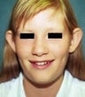 11 year old female patient
