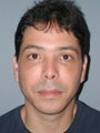 Chin Augmentation, Chin Surgery