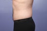 37 yr old male weight loss patient