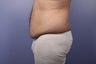 37 yr old male weight loss patient