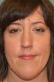 Mole Removal, Surgical Mole removal, Mole removal plastic surgery, mole removal procedure