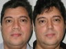 45 Year Old Male for Primary Rhinoplasty