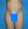54 Year Old Female