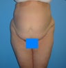 54 Year Old Female