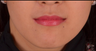 Natural smile comes from upturned mouth corners