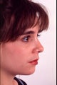 Rhinoplasty for long nose with large tip