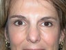 45 year old woman who looks more tired than she feels