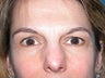 45 year old woman who looks more tired than she feels