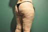 Cellulaze