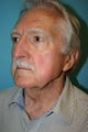 75 Year Old Male Interested in Facial Rejuvenation