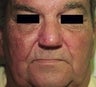 57 year old male patient