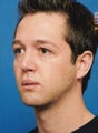 Chin Augmentation