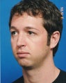 Chin Augmentation