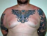 Adult Male treated for Breast Reduction