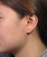 Gauge Earring Defect Repair