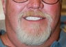 All-on-4 Dental Implants
