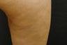 Cellulaze