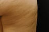 Cellulaze
