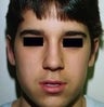 14 year old male patient