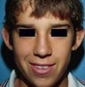 14 year old male patient