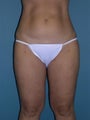 40 year old; 5'2"; 152 pounds