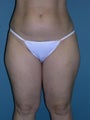 40 year old; 5'2"; 152 pounds