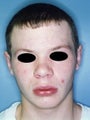 17 year old male patient