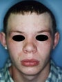 17 year old male patient