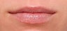 Vascular lesion and photoaging on lips treated with IPL