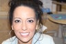 All-on-4 Dental Implants