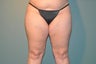 Cellulaze