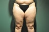 Cellulaze