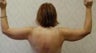 Armlift