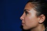 Rhinoplasty