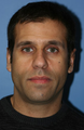 Otoplasty